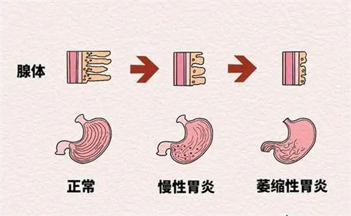 年轻人喝了啤酒喝白酒好吗  3